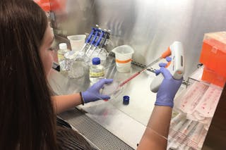 Student Korbyn Dahlquist ’20 is part of a research team developing less-invasive test for non-alcoholic fatty liver disease (NAFLD).